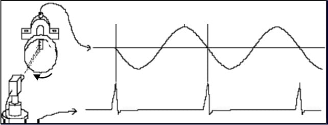 Entonces esta figura está aquí. Figura 6.2 - Medición sincronizada con la velocidad de la máquina